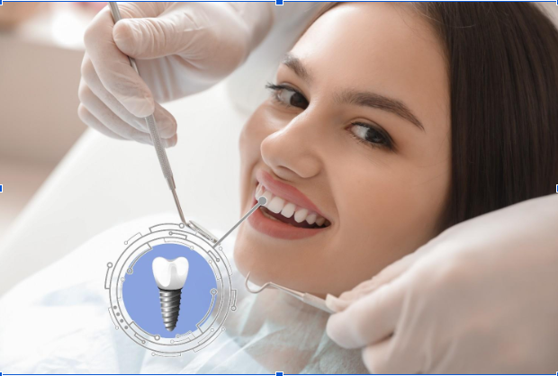 implantation dentistry